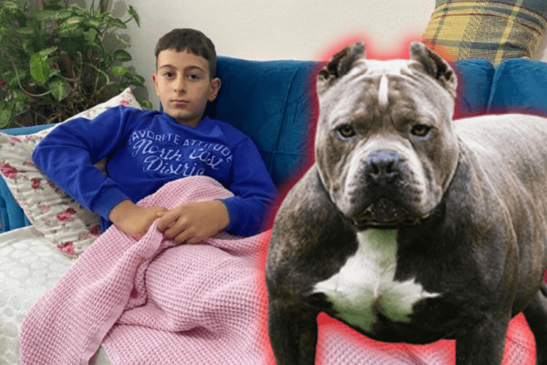 Çorlu’da Pitbull saldırısında 10 yaşındaki Baran yaralandı