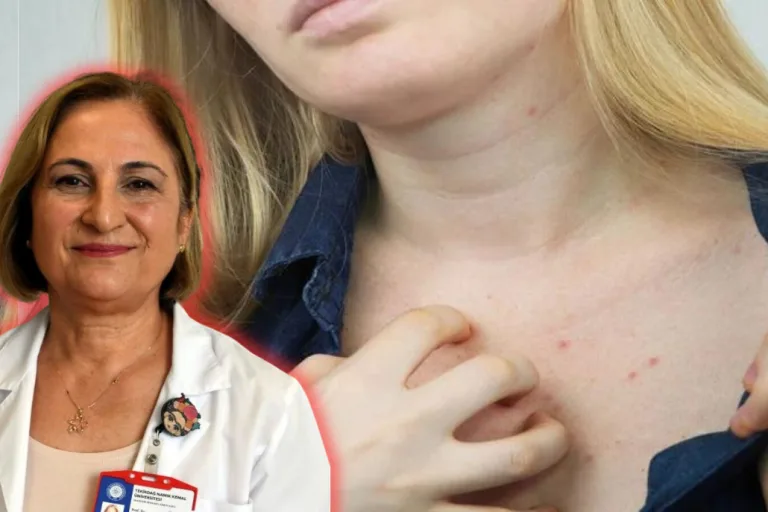 Aytekin: Polikliniğe Gelen Hastaların Yüzde 10’u Uyuz!
