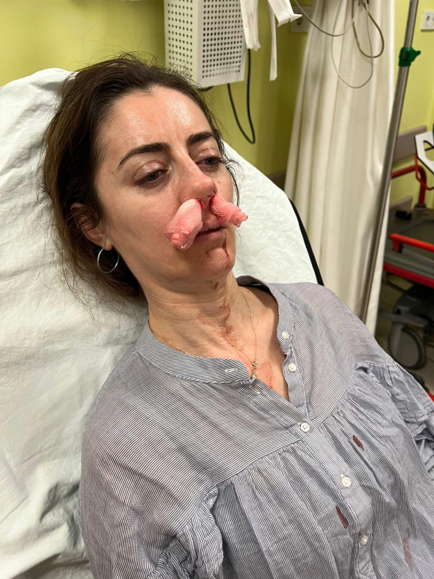 Kendisini eşinin sevgilisi zanneden kadın tarafından darbedildi Kendisini eşinin sevgilisi zanneden kadın tarafından darbedildi