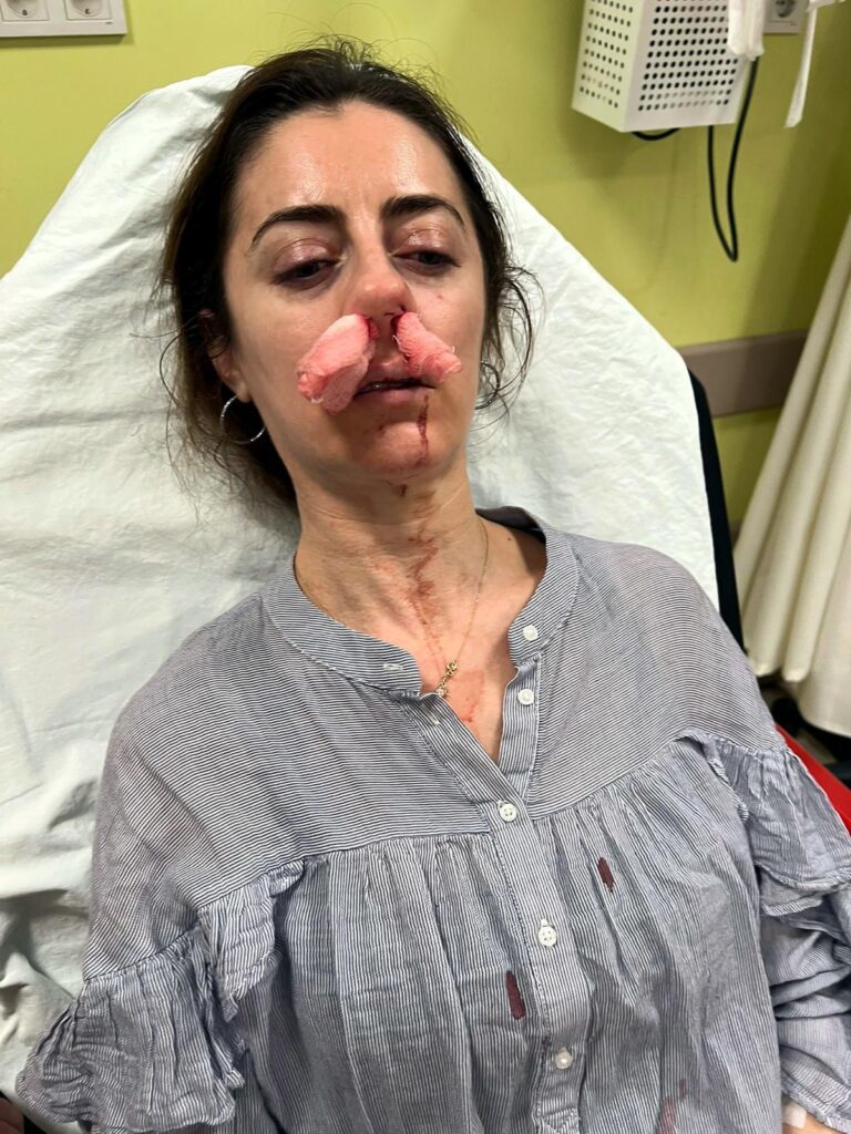 Eşinin sevgilisi sandığı kadını darbettiği ‘otomobil kapısı’, ‘silah’ sayıldı