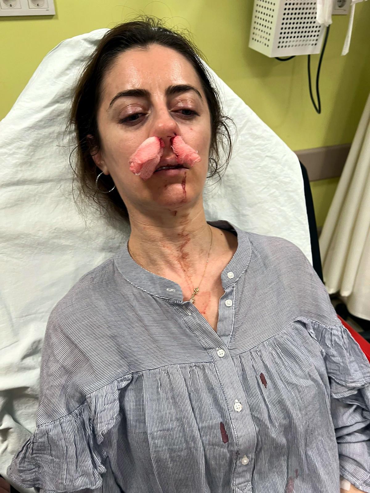 Eşinin sevgilisi sandığı kadını darbettiği ‘otomobil kapısı’, ‘silah’ sayıldı Eşinin sevgilisi sandığı kadını darbettiği ‘otomobil kapısı’, ‘silah’ sayıldı
