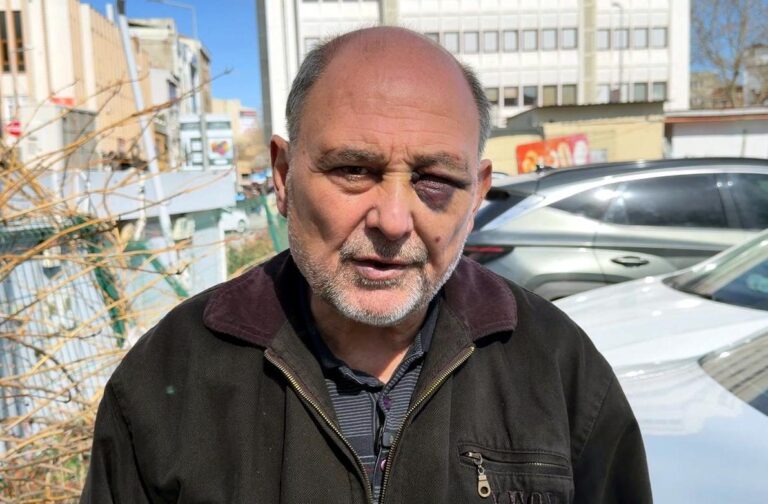 Annesinin Cenazesinden Dönüşte 3 Kişi Tarafından Darbedildi: